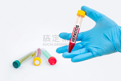 肝炎,试管,医学检测,黄疸病,乙型肝炎病毒,瘟疫,医疗保险,水平画幅,科学,健康保健