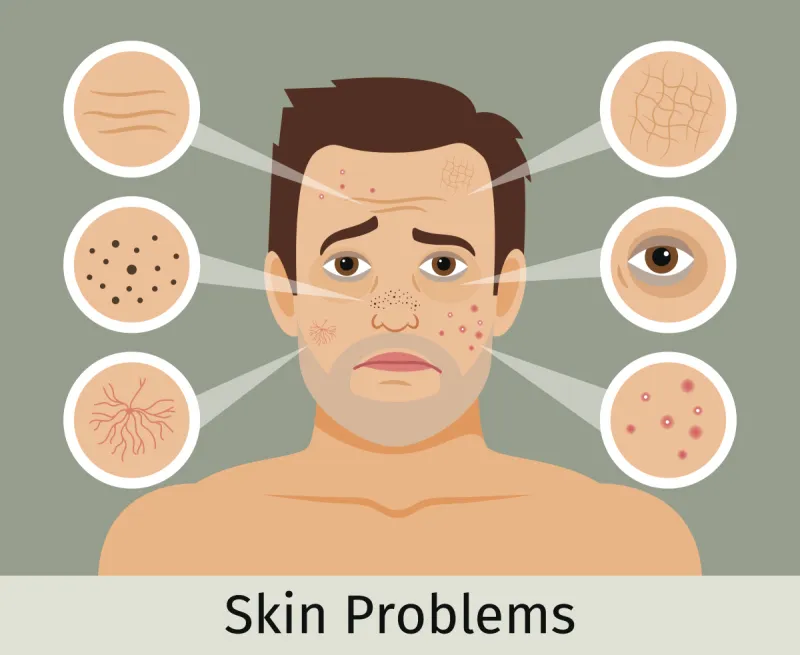 男性 问题 皮肤 疙瘩 干的 粉刺 皱纹 美容院 皮肤病学 面膜图片素材下载 稿定素材