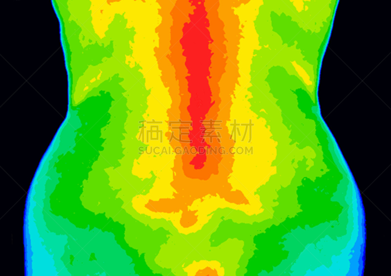 炎症,荐骨,热成像,红外摄影,骶骨,医学扫描,脊柱,热,温度