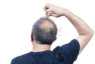 非全秃,发际线后移,秃头,不理的,剃光头,水平画幅,白人,特写,男性,仅男人