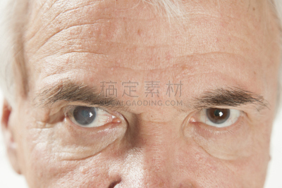 人的眼睛,老年男人,角膜,青光眼,白内障,近视,视网膜,视觉缺陷,验眼设备,视力