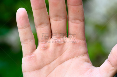 手,水泡,水平画幅,人体,手指,人,背景分离,棕榈树,粗糙的,开着的