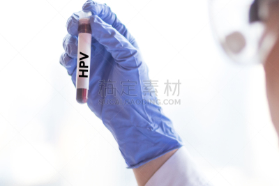医生,蓝色,概念,健康保健,病毒,装管,人乳头状瘤病毒 ,白色,人,拿着