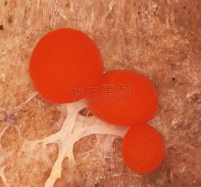 黏菌,红色,绒胞菌属,菌核,原形体,单细胞生物,阿米巴,微球菌,原生动物,微生物