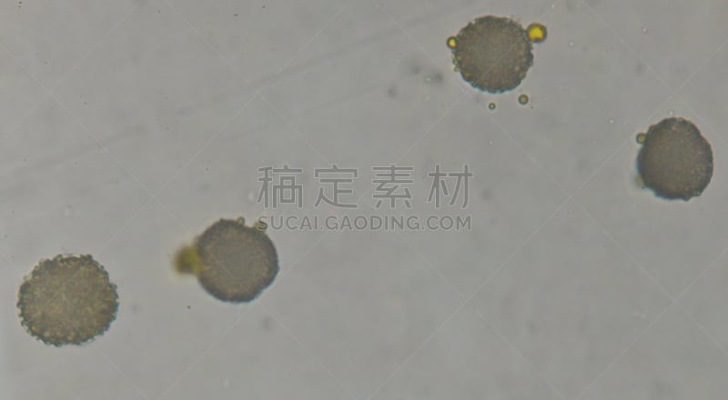 动物细胞,植物细胞,大规模的放大,干细胞,细胞核,真核生物,生理学,人体细胞,水平画幅,形状