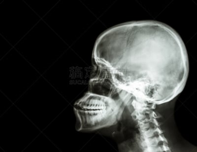 影片,x光,看风景,脊柱,头骨,宫颈巴氏涂片,脑部,魟,图像,仅男人