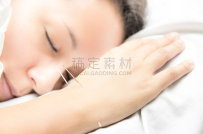 针灸,耐性,针,手臂,美,女人,水平画幅,美人,人的嘴,丝状的