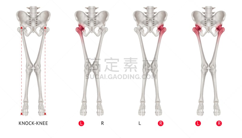 膝,白色背景,健康保健,臀,腿,红色,顺序,荧光笔,敲门