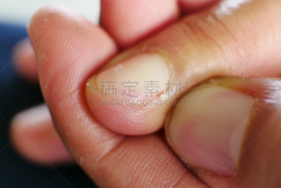 脆弱,指甲,垂直画幅,彩妆,spa美容,干的,真菌,钉子,虚弱