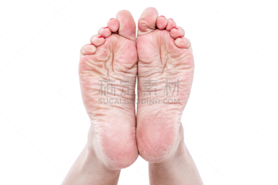 足,皮肤,干旱,皮炎,皮肤病学,四肢,平视角,腿,干的,男性