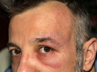 过敏反应,四个物体,水平画幅,偏见,特写,人的眼睛,前额,人的脸部,成年的