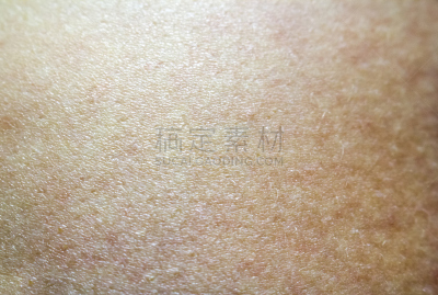 人,果皮,灰色斑纹马,维管束,皮炎,式样,水平画幅,皮肤病学,抽象,斑点