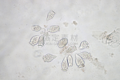 钟形虫,原生动物,视角,在下面,纤毛,纤毛虫,阿米巴,风铃草属,无形的,真核生物