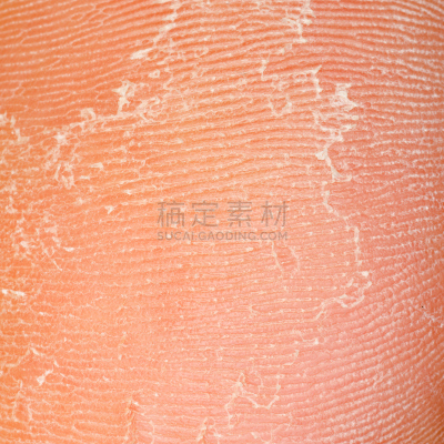 干的,纹理,皮肤,皮炎,在下面,化妆用品,特写,部分,大特写