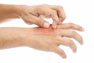 垃圾,身体受伤,替代疗法,辅导讲座,四肢,水平画幅,努力,仅男人,仅成年人,皮炎