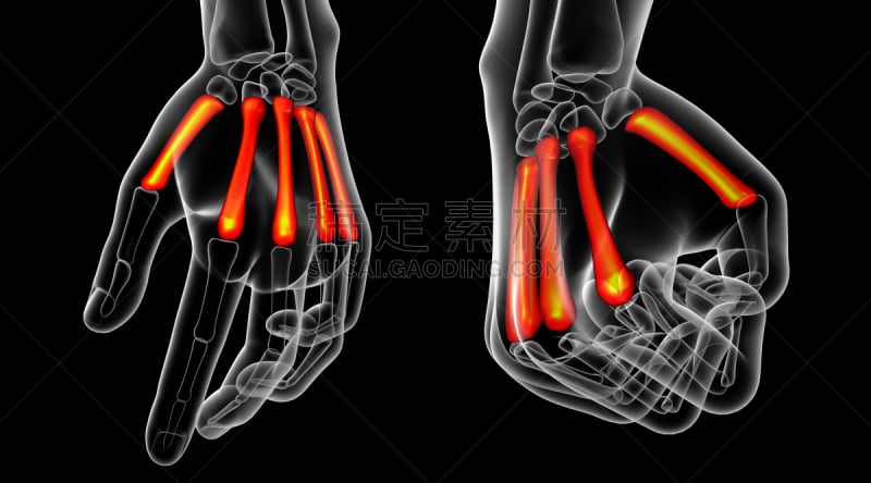 掌骨,三维图形,骨骼,健康保健,绘画插图,趾骨,骨关节炎,肌腱,风湿病,人类骨架