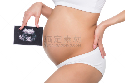超声波,医学扫描,女人,美,水平画幅,父母,腹腔,仅成年人,部分