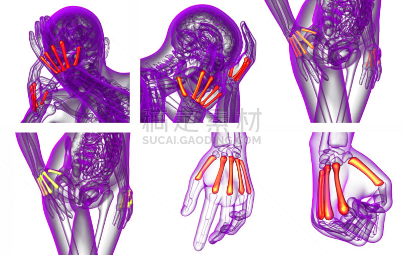 掌骨,三维图形,骨骼,绘画插图,健康保健,趾骨,骨关节炎,肌腱,风湿病,人类骨架