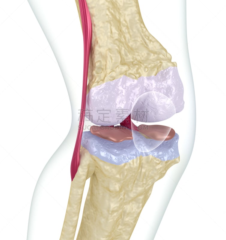 骨质疏松症,膝,垂直画幅,人类骨架,韧带,形状,绘画插图,科学,生物学,软骨