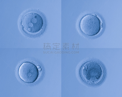 人体细胞,卵,人类兹戈特,人工授精,干细胞,孕检,染色体,显微镜,人造的,生物科技