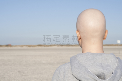 秃头,女人,看风景,何杰金病,淋巴瘤,癌细胞,白血病,癌症,化疗药物,药物的副作用