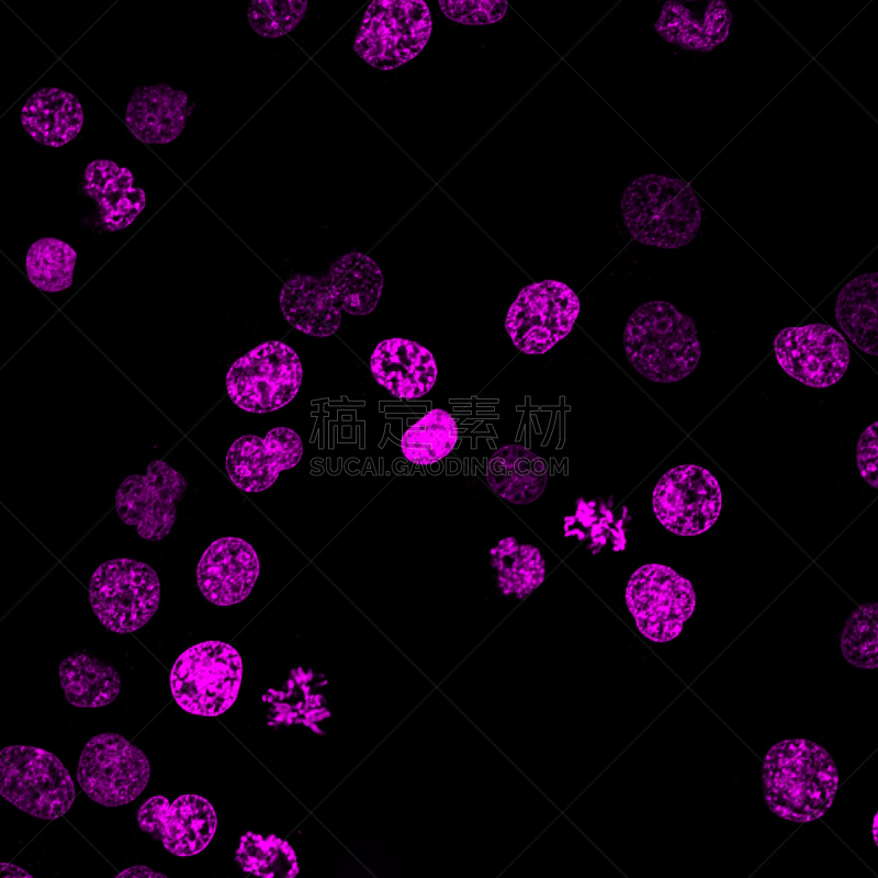 荧光灯,白血病的,分子,显微镜,细胞核,白血病,科学实验,科学,生物学