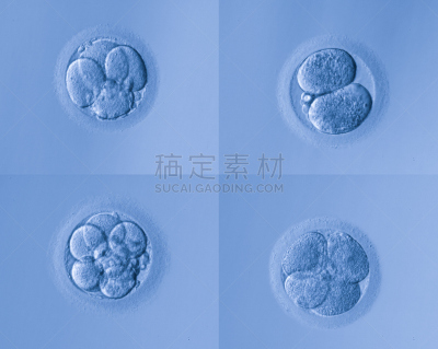 卵,人类兹戈特,人工授精,干细胞,显微镜,人造的,生物科技,水平画幅,显微图片