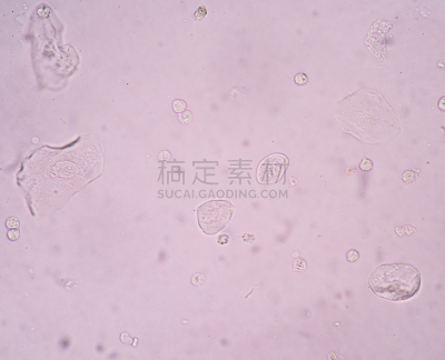 上皮细胞,膀胱,颊的,鳞状上皮,微生物学,2015年,图像,水平画幅,肮脏的,摄影