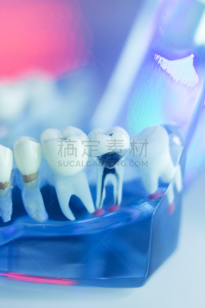 牙医,人的嘴,口腔卫生,人的牙齿,模型,垂直画幅,人造的,假牙,使用嘴巴,干净
