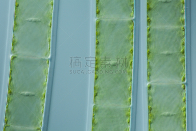 微生物,绿色,水棉属绿藻,接合孢子囊,富营养化水体,胶浆,细胞质,细胞膜,光显微图,大规模的放大