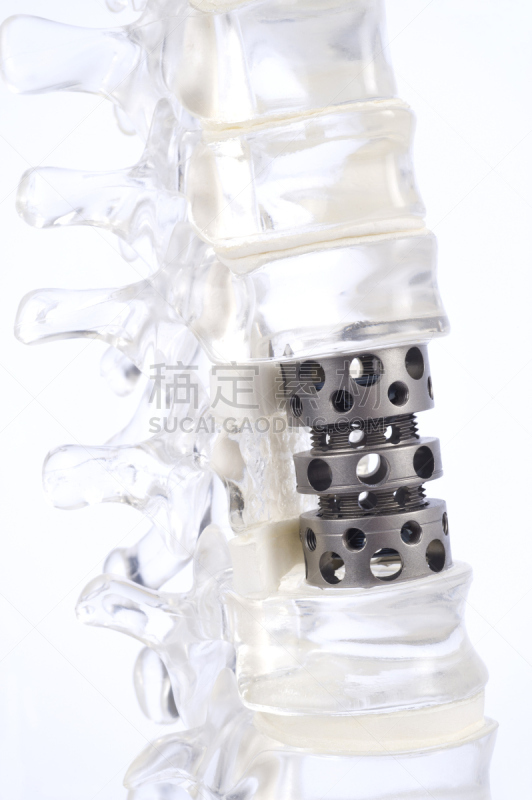脊柱,模型,椎间盘,腰椎,脊椎,垂直画幅,人造的,神经系统,健康保健