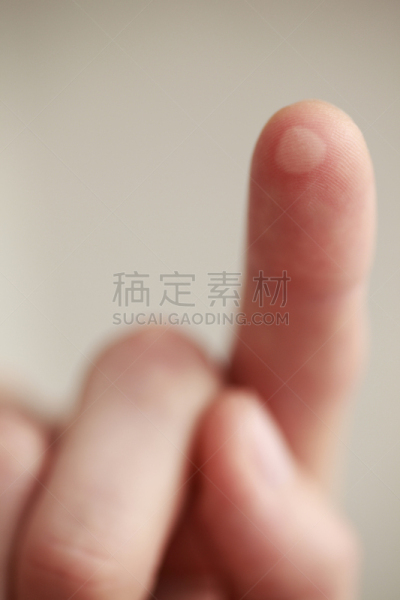 食指,肿胀的,水泡,健康保健,部分,背景分离,灵感,想法,影棚拍摄,问题