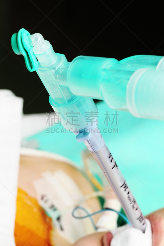病人,人类肺脏,风管,人造的,气管切开术,心脏复苏术,加护病房,医用氧气设备,哮喘
