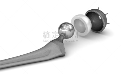 白色,隆胸手术,准确,分离着色,三维图形,人工髋关节,人造的,水平画幅,束带,金属