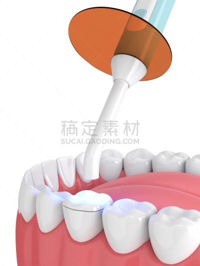 口腔卫生,照明设备,三维图形,灯,准备食物,人的嘴,健康保健,龋齿,背景分离,药