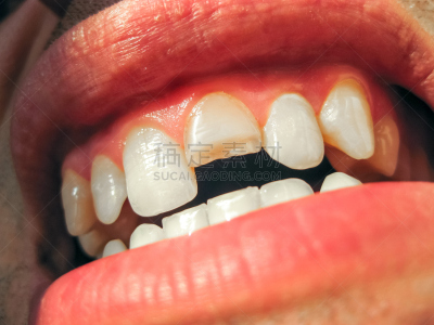 人的嘴,男人,牙齿,人的牙齿,顶部,专业人员,药,坏掉的,古董,犬科的