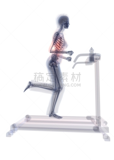 跑步机,X光片,休闲追求,径赛项目,健身俱乐部,背景分离,生活方式,四肢,行动