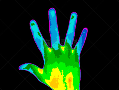 多发性硬化,手,温度计,温度,水平画幅,红外摄影,科学,图像,特写,硬化症