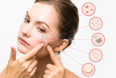 疙瘩,女人,斑点,皮肤,皱纹,雀斑,恶作剧,正面视角,彩妆,衰老过程