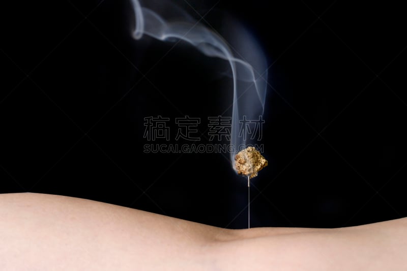 亚洲,传统,热,针灸,图像,火,无人,背景,水平画幅,艾灸