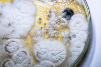 传媒,微生物学,酵母,放线菌属,土样,细菌,实验室,霉菌,学习