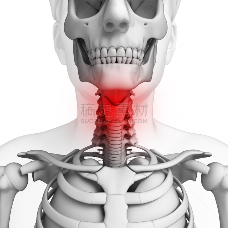 脖子,痛苦,艺术品,甲状软骨,气管,胸腔,喉咙,胸部,人类骨架,形状