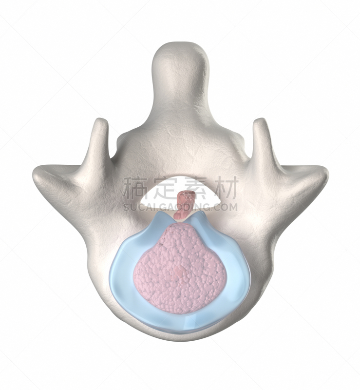 椎间盘,舞台,垂直画幅,脊髓神经,颈椎,脊柱,健康保健,关节炎,特写