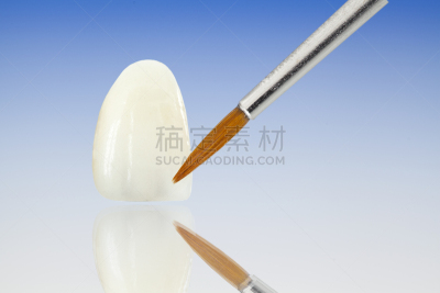 口腔卫生,金属,王冠,皇后,牙冠,牙移植,人造的,水平画幅,无人,牙医