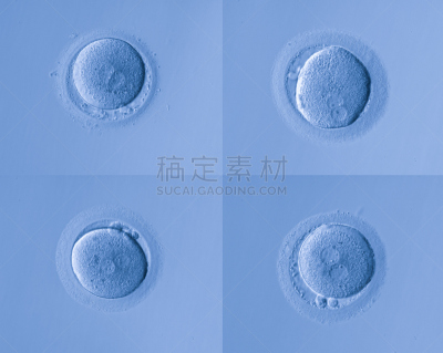 人体细胞,卵,人类兹戈特,人工授精,干细胞,孕检,染色体,显微镜,人造的,生物科技