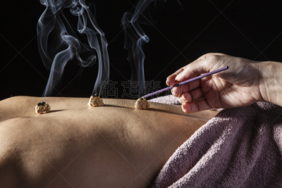 艾灸,背面视角,女人,羊毛帽,针灸针,青少年,水平画幅,烟,特写