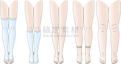 肿胀的,腿,不,胫骨,超小号,部分,厚的,2015年,筋疲力尽,绘画插图