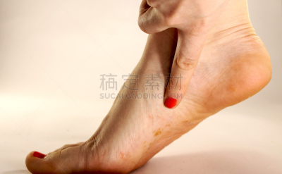 真菌,足,药,特写,概念,皮肤病学,白色背景,人,摄影,生病