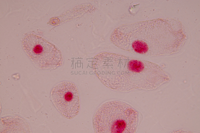 显微镜,有丝分裂,细胞,在下面,洋葱,草药,染料,根尖,粳米,生物学