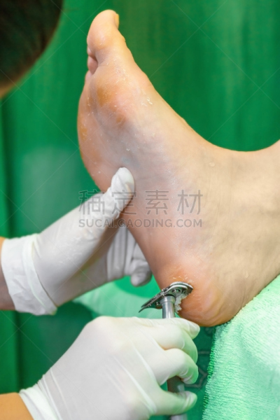 美容院,医疗流程,温泉鱼疗,太平洋油鲽,脚掌,人类脚趾,足,破碎的,擦菜板